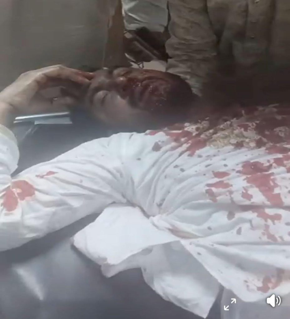 নুরুল হক নুরের রক্তাক্ত ছবি ফেসবুকে পোস্ট করে ক্ষোভ প্রকাশ হাসনাত আব্দুল্লাহর